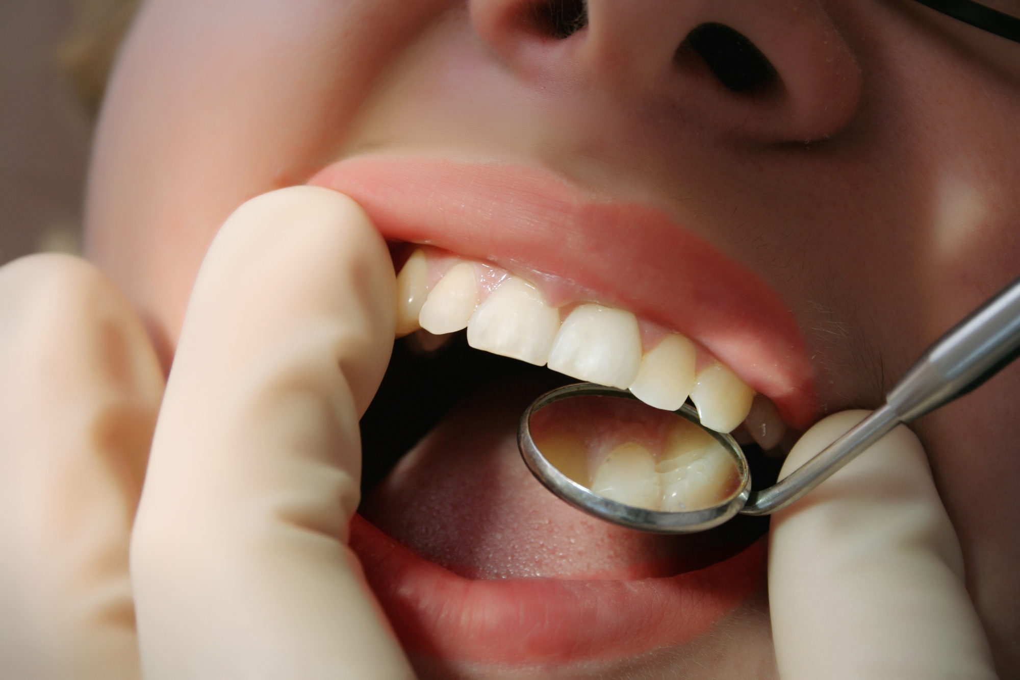 What is Dental Debridement? Konig Center for Cosmetic & Comprehensive